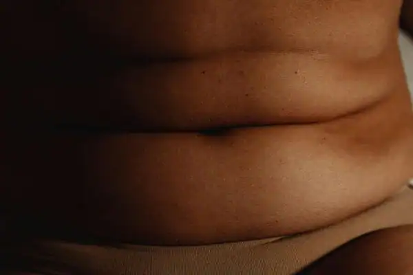 The Hidden Connection: How Stress Shapes Your Fitness and Body Composition 3 image of what stress can do on the stomach area and how Lipo 360 Dorchester can help to change your body shape.